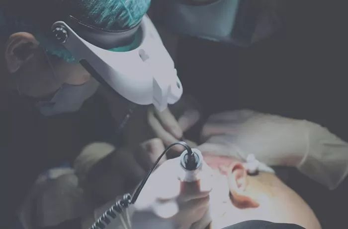 ERHA Hadirkan Hair Transplant